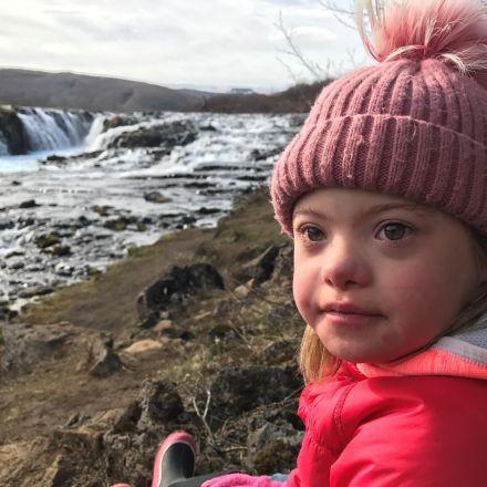 Why Down syndrome in Iceland has almost disappeared