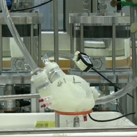 Behold, the First Totally Soft Artificial Heart