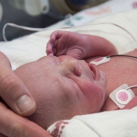 Woman With Transplanted Uterus Gives Birth, the First in the U.S.