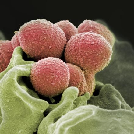 Researchers find trigger that turns strep infections into flesh-eating disease