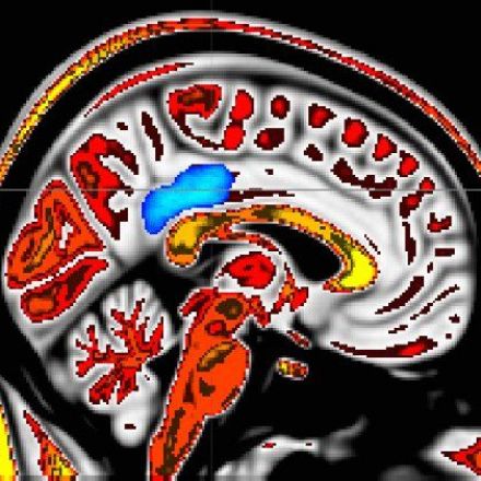 'Mindful people' feel less pain; MRI imaging pinpoints supporting brain activity
