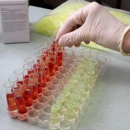 New blood test predicts risk of heart attack and stroke with twice previous accuracy