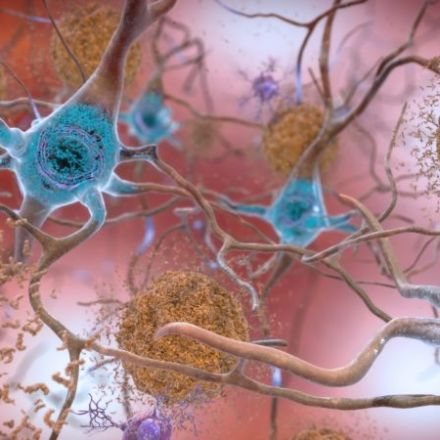 European Scientists Have Made an Intriguing Discovery in Alzheimer's Drug Research