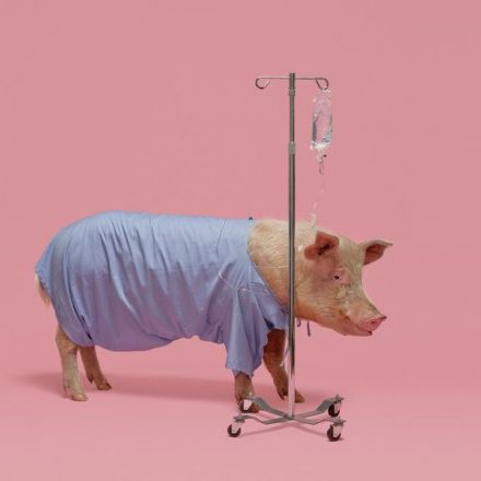 20 Americans Die Each Day Waiting for Organs. Can Pigs Save Them?