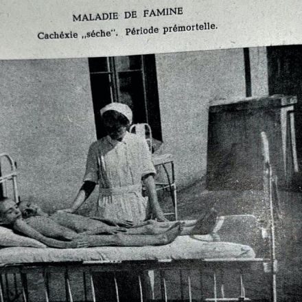 Warsaw Ghetto's defiant Jewish doctors secretly documented the medical effects of Nazi starvation
