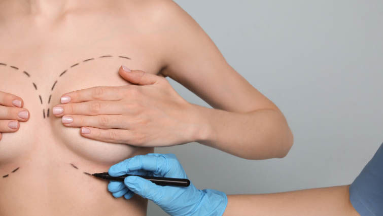 Breast reconstruction surgeons in South Florida
