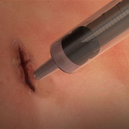 How Superglue Made of Human Protein Heals Wounds