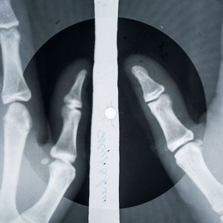 Bone Music: Stephen was intrigued when he found an X-ray record at a Russian market. What he discovered inspired him