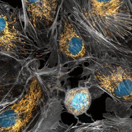 Radical Findings Show Mitochondrial DNA Can Be Inherited From Dads
