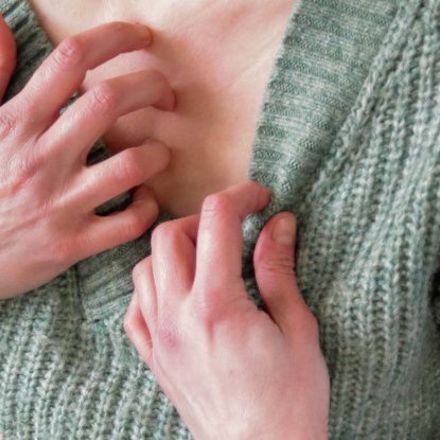 Scientists Have Finally Figured Out What Ignites Endless Itching in Eczema
