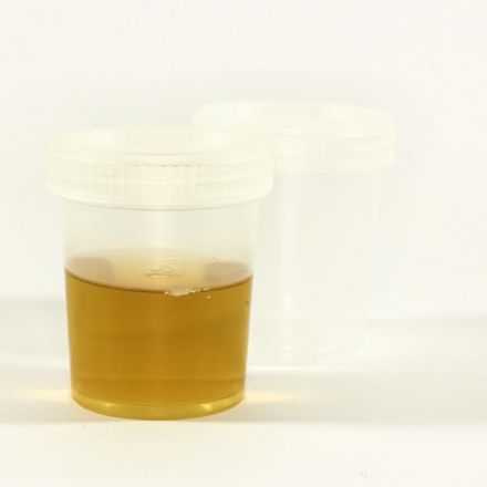 Urine fertilizer: 'Aging' effectively protects against transfer of antibiotic resistance