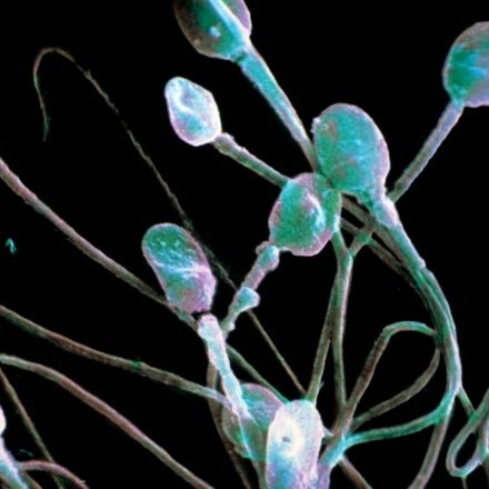 What we know so far about how covid-19 affects sperm