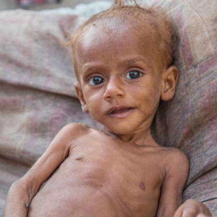 Almost 85,000 children under five may have starved to death in Yemen