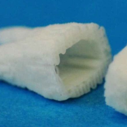 Stem Cell Dental Implants Grow New Teeth In 2 Months!