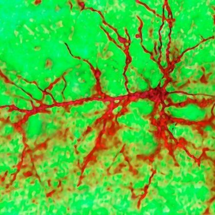The Adult Brain Does Grow New Neurons After All, Study Says