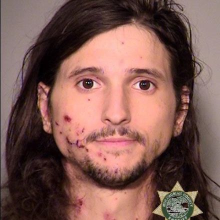 Chunks of a Portland Man's Exploded Hand Struck a Federal Officer. He's Charged With Assault.