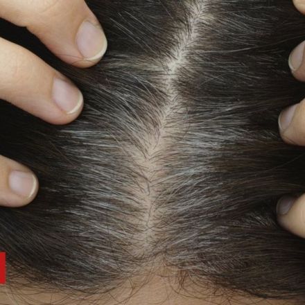 Scientists discover 'why stress turns hair white'