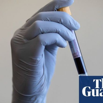 Blood test spots multiple cancers without clear symptoms, study finds
