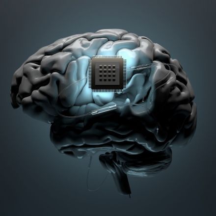Brain Implants Will Arrive Sooner Than You Think. What Does That Mean?