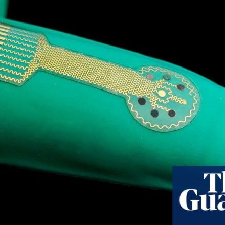 ‘Smart bandage’ with biosensors could help chronic wounds heal, study claims
