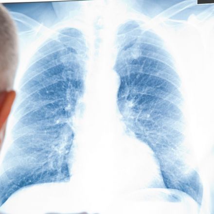 A daily pill could cut lung cancer deaths in half, new study shows