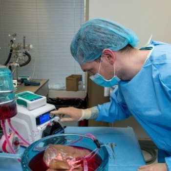 Doctors have put human livers in suspended animation