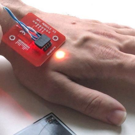 The microchip implants that let you pay with your hand
