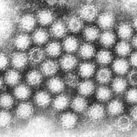 Disruption of the Human Gut Microbiota following Norovirus Infection