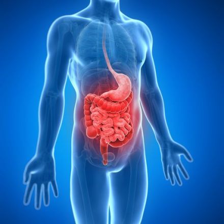Ulcerative colitis and Crohn's: Is 21st century living to blame?