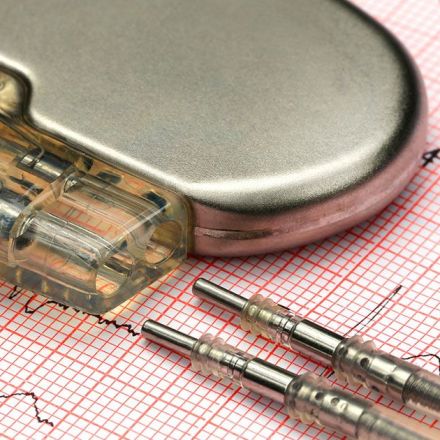 ‘Bionic’ pacemaker reverses heart failure - The University of Auckland