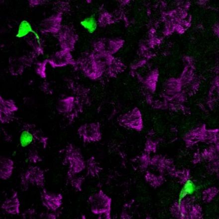 New Lung Cell Type Discovered