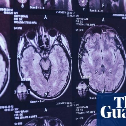 Mystery brain disorder baffles Canadian doctors