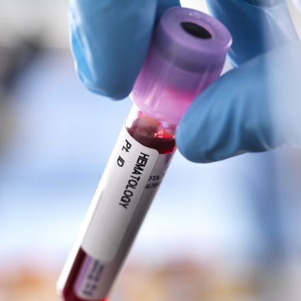 Researchers Move Closer to a Blood Test for Predicting When People Might Die