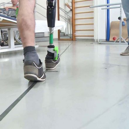 A prosthetic leg that attaches to nerves feels like part of the body