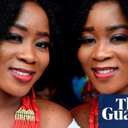 Identical twins are not so identical, study suggests
